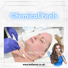 Chemical Peels treatment at Bella Mai. Terri Tibbles appling a facial peel solution using a brush to a client’s face.