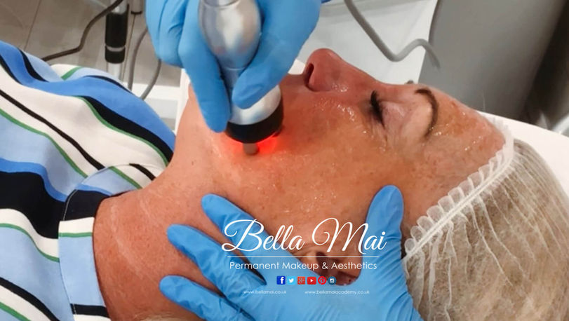 Radio Frequency facial skin tightening results - Bella Mai Essex