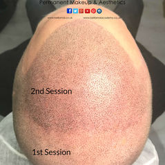 ProQual Level 4 Ofqual Regulated Certificate in Scalp Micropigmentation Training in Thurrock Essex. Bella Mai Academy