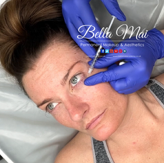 Anti-wrinkle treatment results on the under eye. Grays. Essex