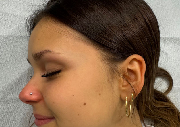 Nostril