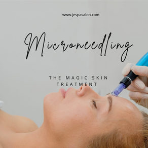 Microneedling — The Skin Care Benefits & Magic Skin Treatment