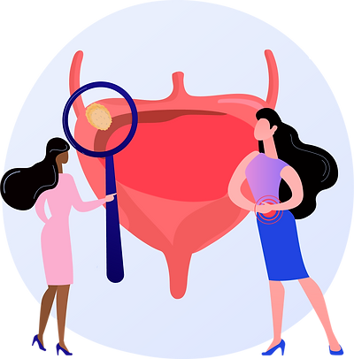 Bladder Cancer