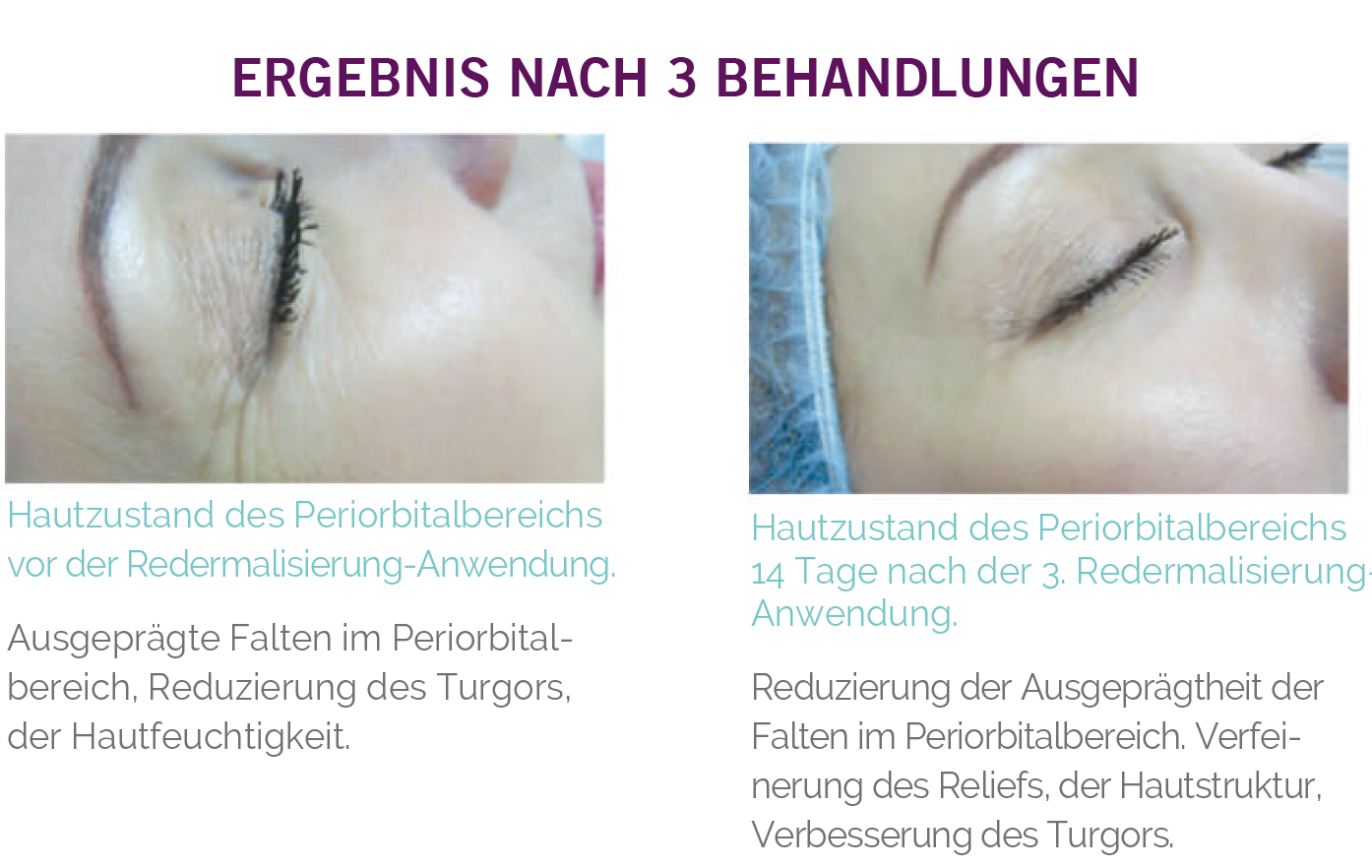 redermalization_02.webp