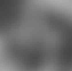 Femme enceinte partageant son témoignage de grossesse à risque avec hydrothorax du bébé, suivi médical à l’hôpital Necker et préparation à l’accouchement.