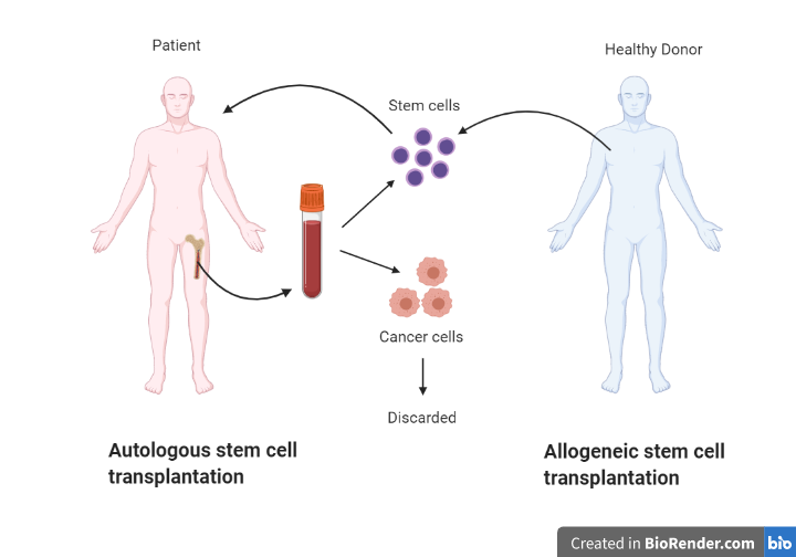 Stem cell therapies - are we there yet?