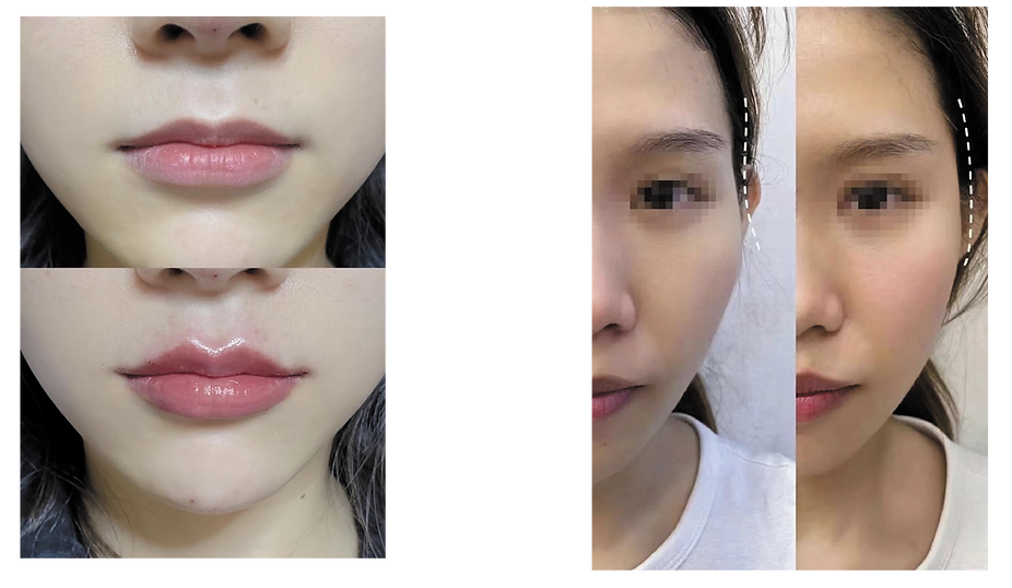 Caratfill Filler 