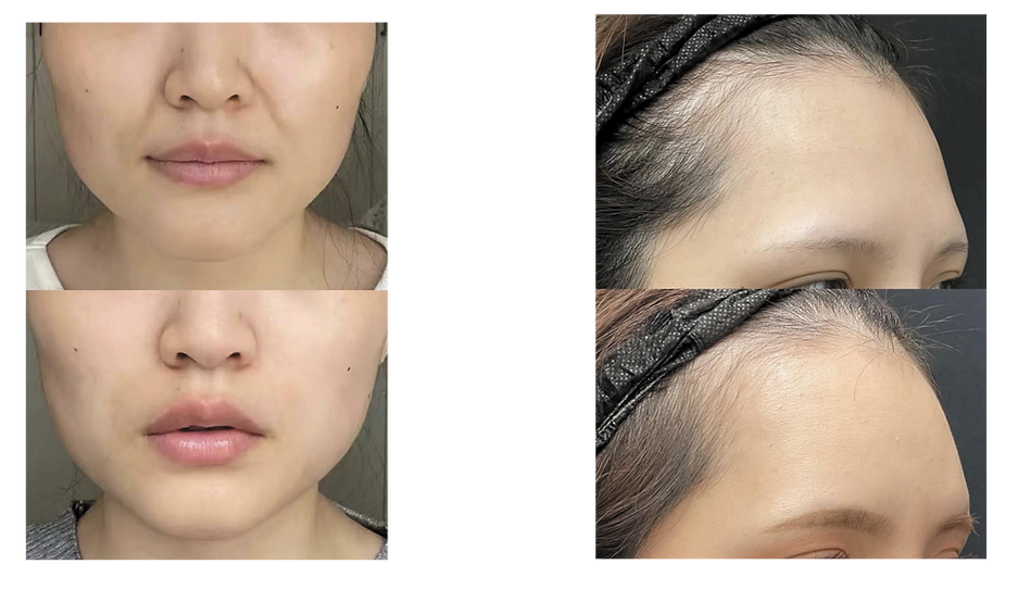 Caratfill Filler 