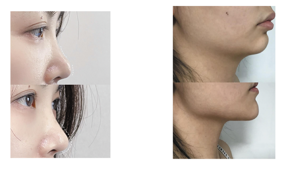 Caratfill Filler 