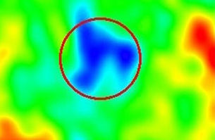 Watch out for cold spots; relieve with shiatsu