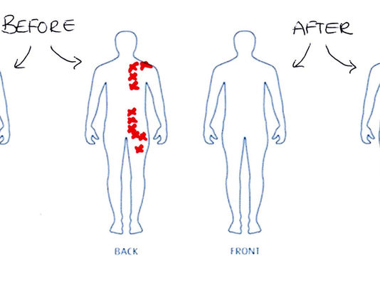 WHAT IS SHIATSU AND HOW IT RELIEVES PAIN!