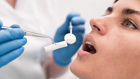 Intervento di chirurgia mucogengivale presso Nuovo Centro Medico Euganeo dentista a Battaglia Terme