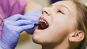 Controlli periodici per bambini presso Nuovo Centro Medico Euganeo dentista a Battaglia Terme