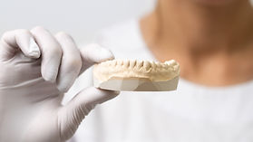 Controllo cementazione della protesi fissa presso Nuovo Centro Medico Euganeo dentista a Battaglia Terme
