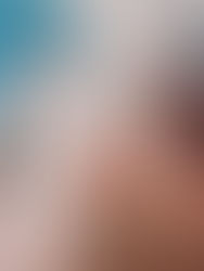 depilação a laser na eclat 