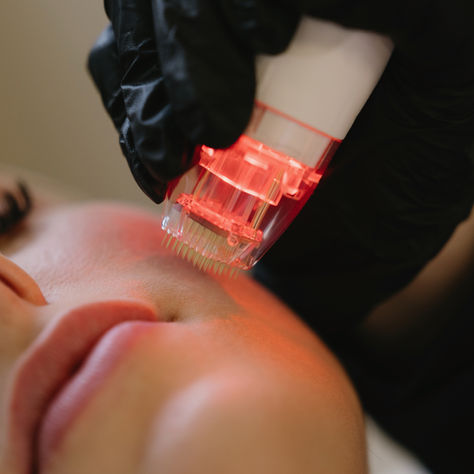 The Nude Lift+™: The Breakthrough in Skin Tightening That Botox® Can’t Deliver