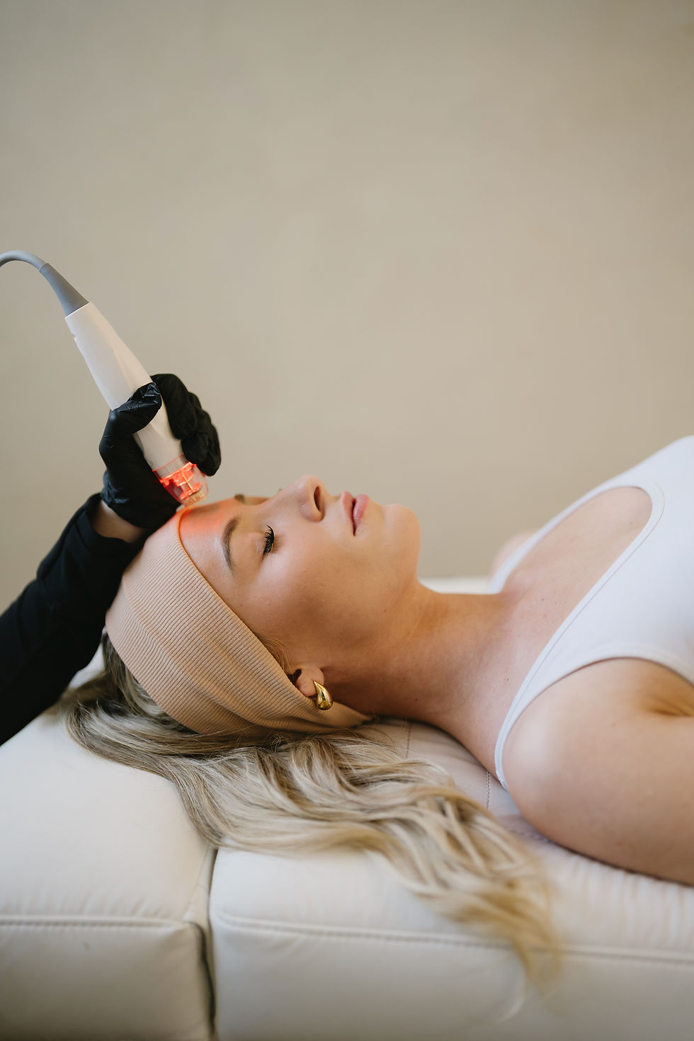 Why Vivace Ultra® RF Microneedling is a Game-Changer for Active Acne Treatment