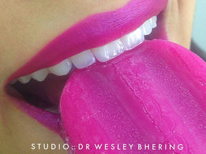 Clareamento sem sensibilidade dental?