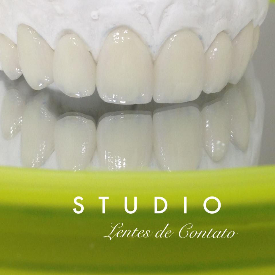 lentes de contato clínica studio, antes e depois, valor, quanto tempo dura, juiz de fora, dentista