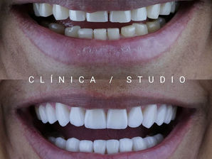 Consigo ficar com o sorriso igual dos famosos?