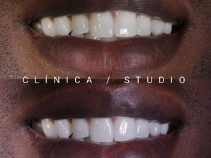 Ter dentes bonitos e brancos pode contribuir para o meu sucesso?