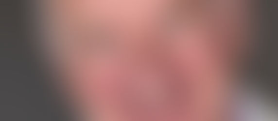 More buzz about Buzz!