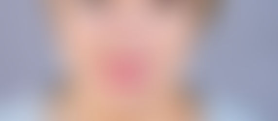 Ann Williams gets "BioSpine!"