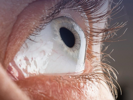 Como saber se o ceratocone está evoluindo?