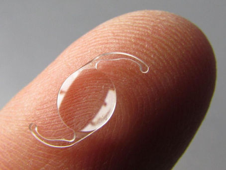 Lente intraocular tem prazo de validade?
