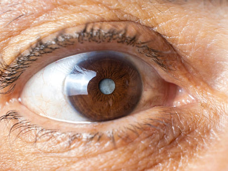 A cirurgia de catarata dói?