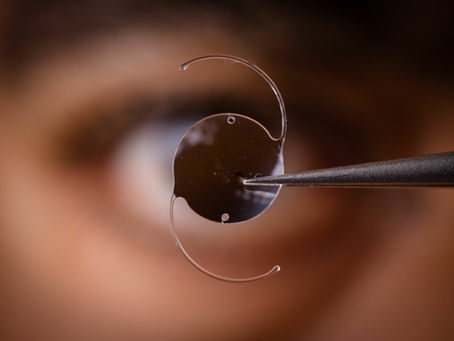 Quais as diferenças entre as lentes intraoculares?