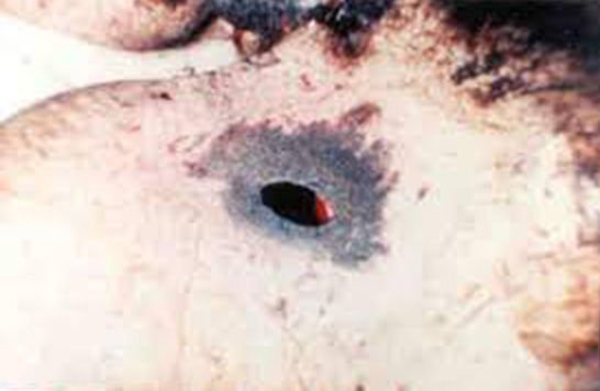 hm_case_10_D.jpg