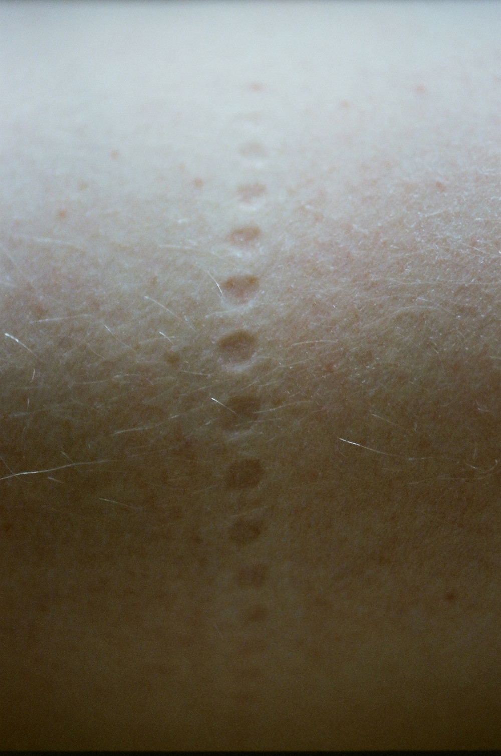 a beautiful photo of a circular dot impressions on a skin from Lina Scheynius photo-essay for Tabayer jewelry