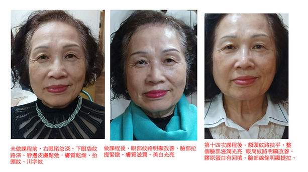 新美容革命商機.011.jpeg