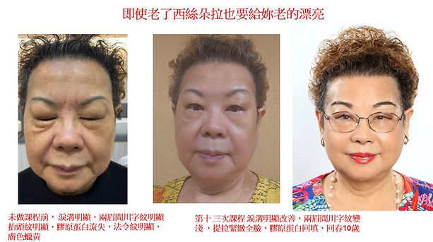 新美容革命商機.006.jpeg