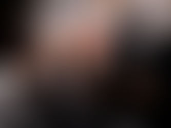 Microneedling in NYC Why Tribeca Med Spa Is a Top Choice