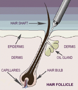 how-does-electrolysis-work-263x300.gif