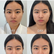 Review 8