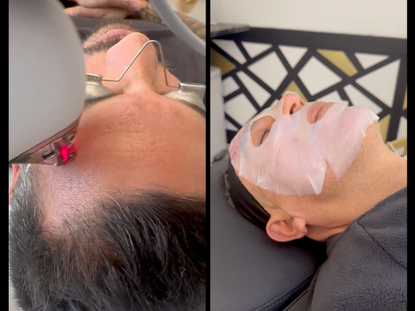     Men's facial treatments NJ – glowing skin after wrinkle release, microneedling and more! Skin rejuvenation at Herasme Beauty.