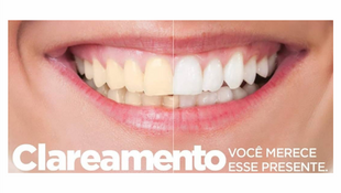 Clareamento Dental: Dicas Essenciais para um Sorriso Mais Branco
