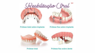 Dicas Essenciais para Quem Usa Prótese Dentária