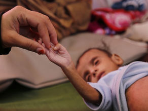 Yemen: Millions of children on the 'brink of starvation'