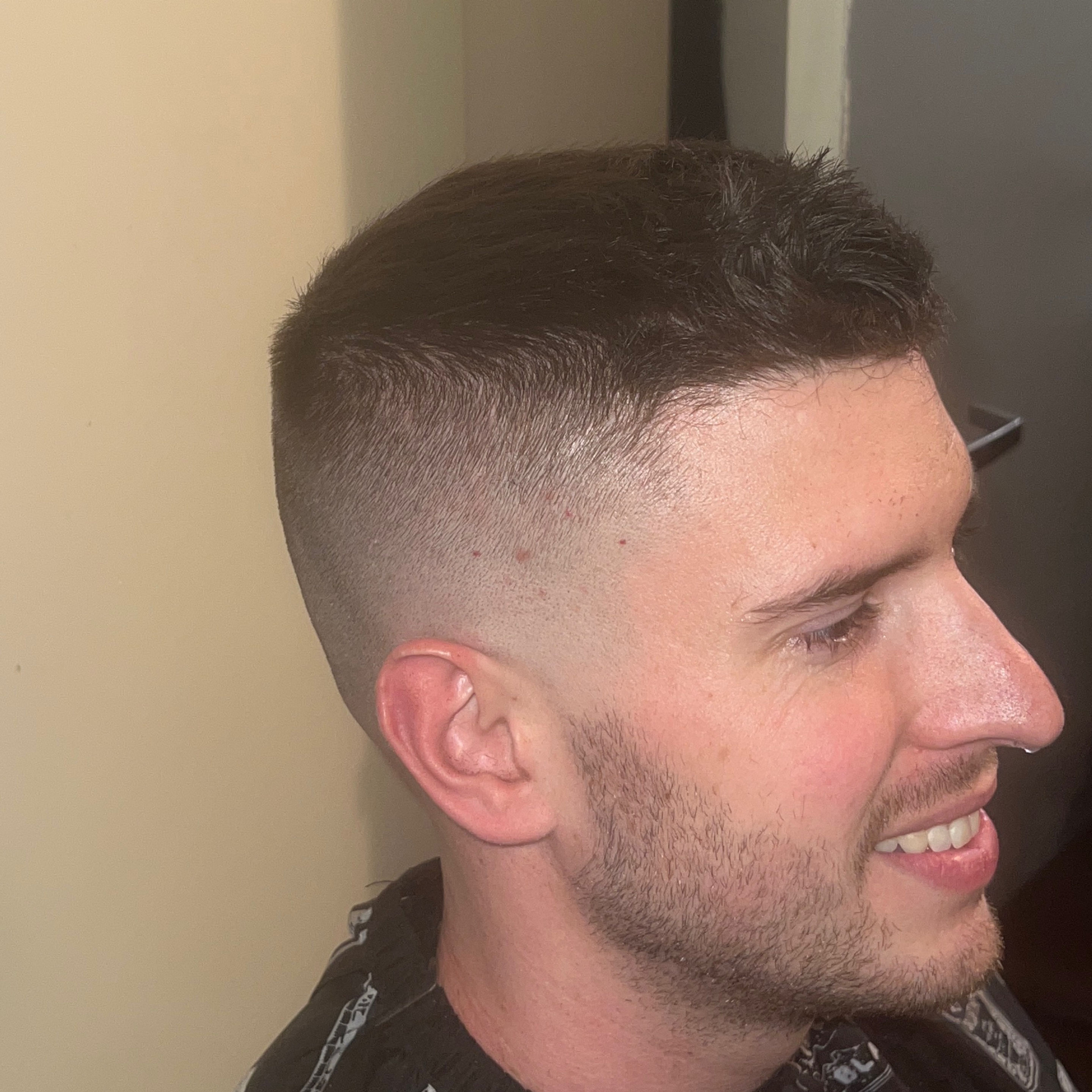 Skin fade