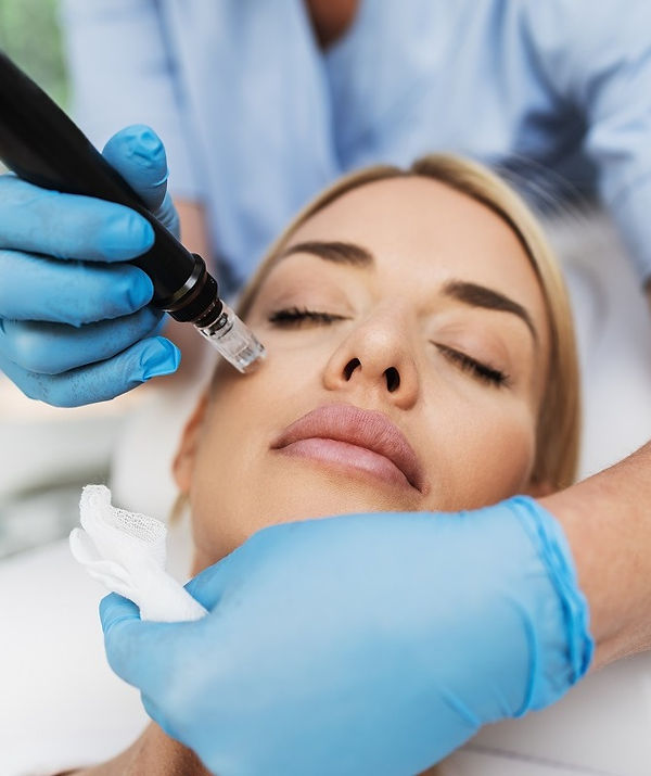 MicroNeedling Dermabrasion