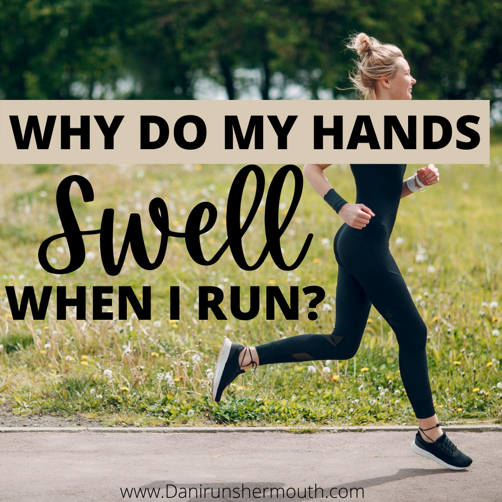 Why Do My Hands Swell When I Run 