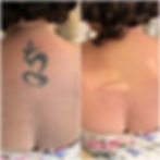 Medium tattoo camouflage