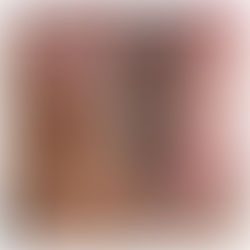 RF Microneedling vs HIFU – Which Is Better For Skin Lifting and Skin Rejuvenation?