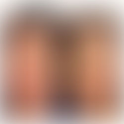 HIFU Treatment – What Age Should You Start and Which HIFU Is Safe?