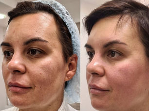 Understanding the Causes of Skin Pigmentation