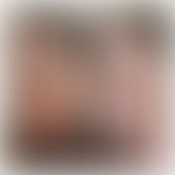 Notox Treatment – The Needle-Free Alternative to Anti-Wrinkle Injections